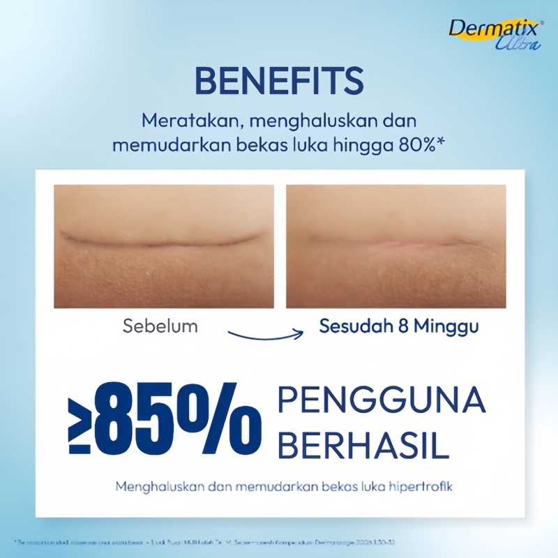 【BUY 3 TAKE 2】Dermatix Ultra Scar Gel 15G Dermatic Acne Scar Reduction Cream Advance Gel Scar Formula Reduce Deep Scars & Post